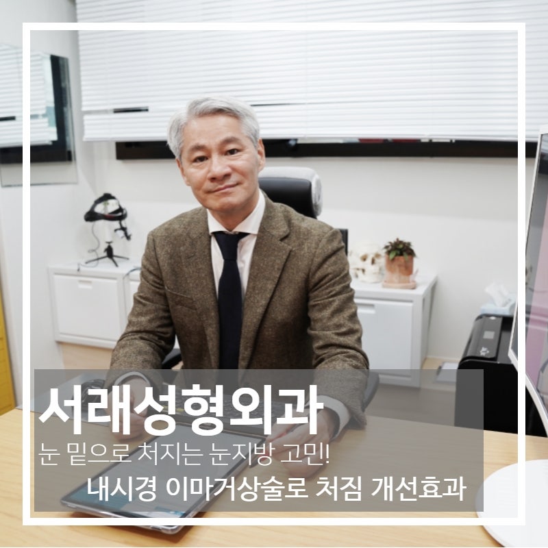 중년이 되면서 처지는 눈, 내시경 이마거상술 이해하고 선택해요
